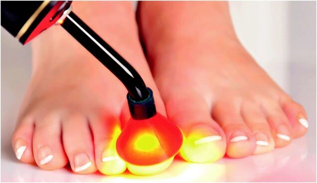 Radiation treatment