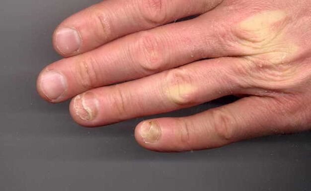 Then in the hands